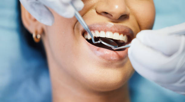 Best Walk-In Emergency Dental Services in Butler, AL